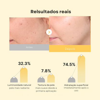 Máscara Jelly Dourada com Ácido Kójico e Cúrcuma - Kit com 4