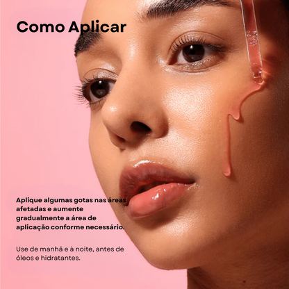 Sérum Niacinamida 10% + TXA 4%