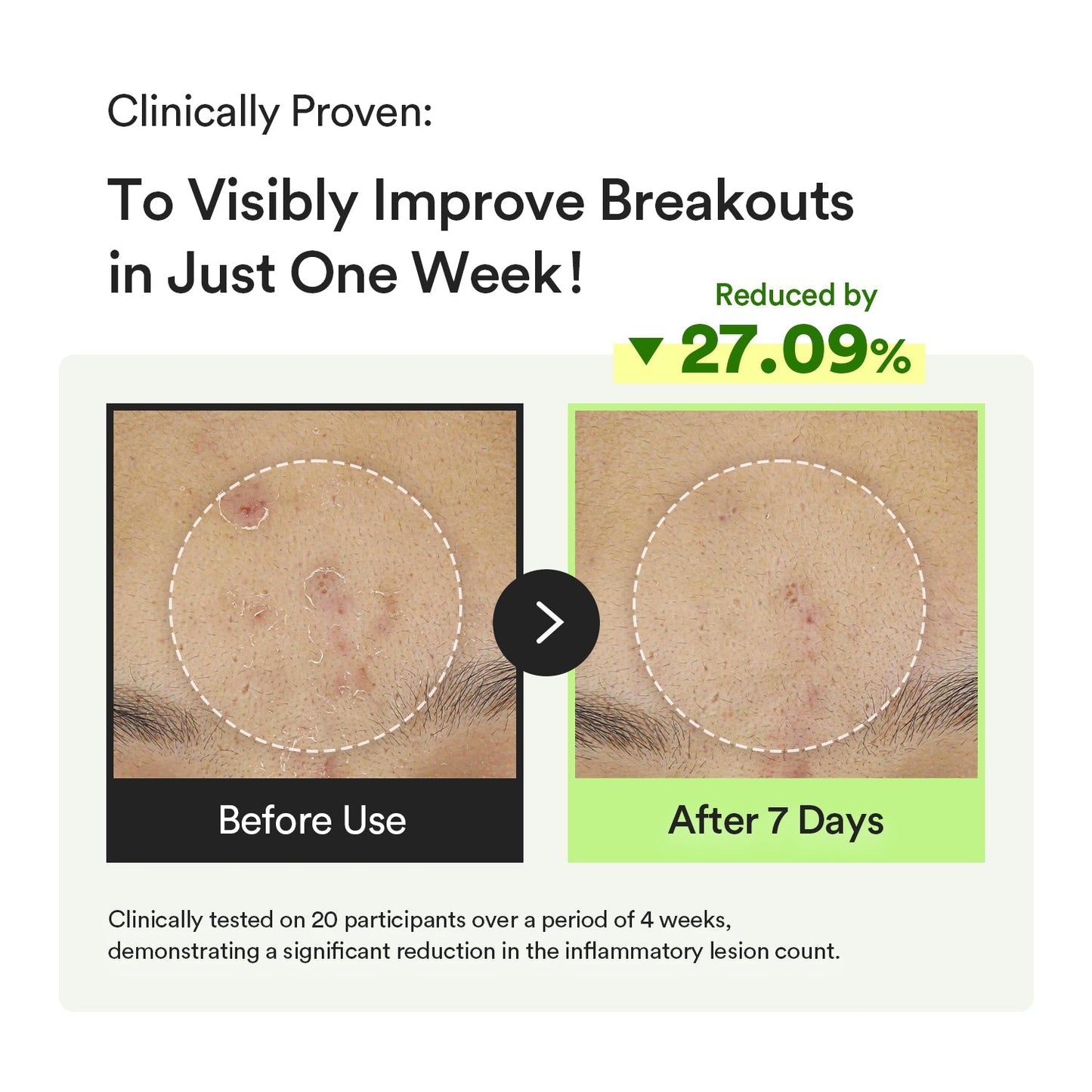 Sérum em Cápsulas de Heartleaf e Teca – Gotas Calmantes