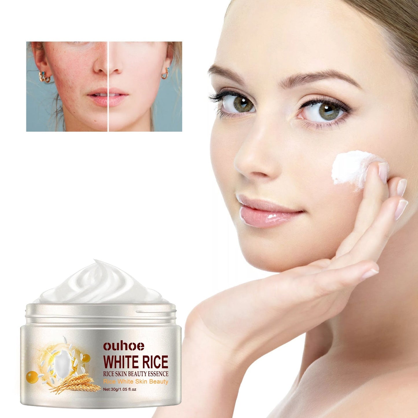 Creme Facial Antirrugas de Arroz – Tratamento para Acne, Melasma e Clareamento - Compre 1 e Leve 3