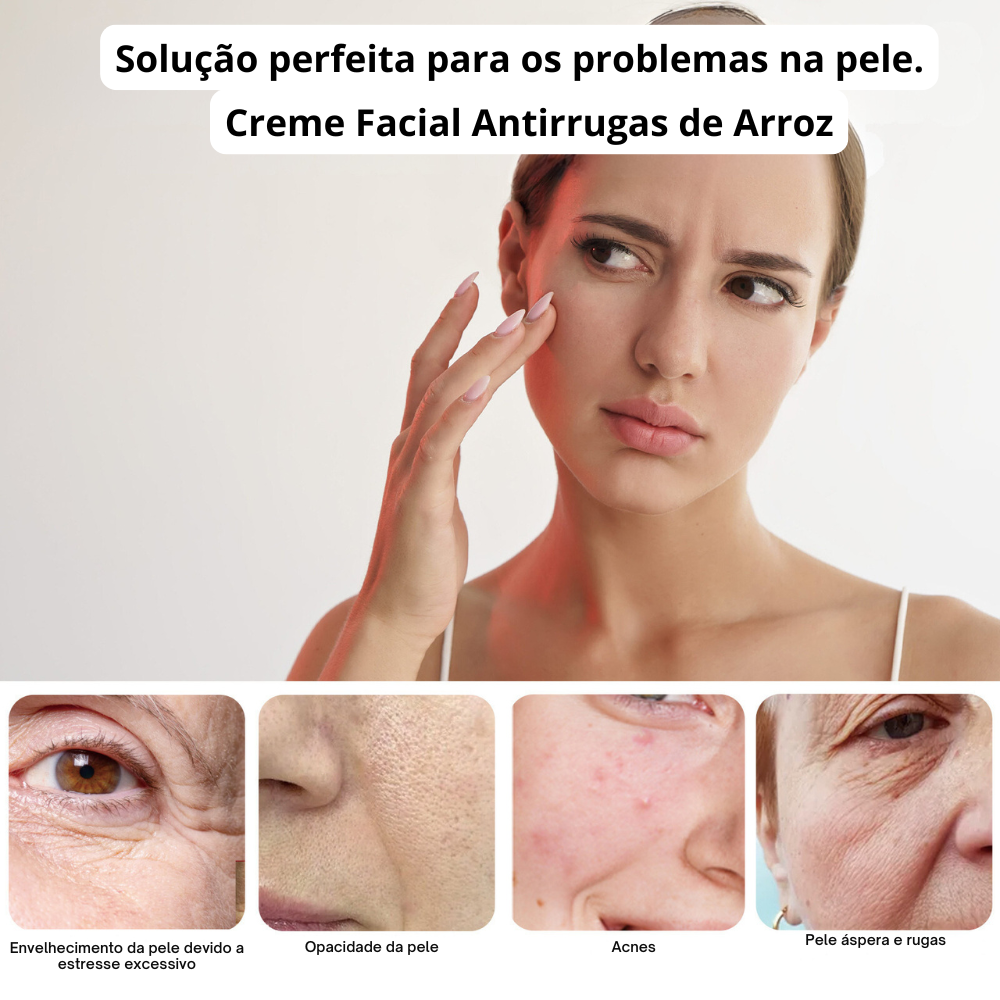 Creme Facial Antirrugas de Arroz – Tratamento para Acne, Melasma e Clareamento - Compre 1 e Leve 3