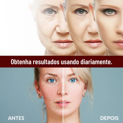 Creme Facial Antirrugas de Arroz – Tratamento para Acne, Melasma e Clareamento - Compre 1 e Leve 3